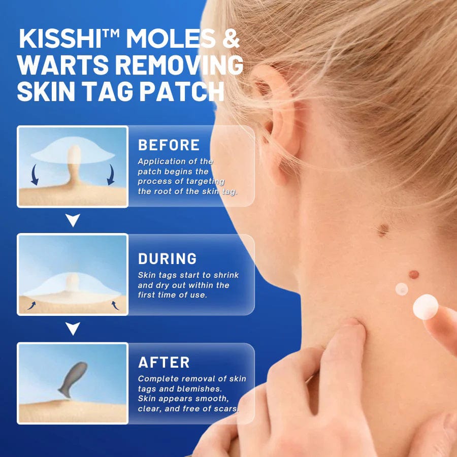 KISSHI™ Moles & Warts Removing Skin Tag Patch