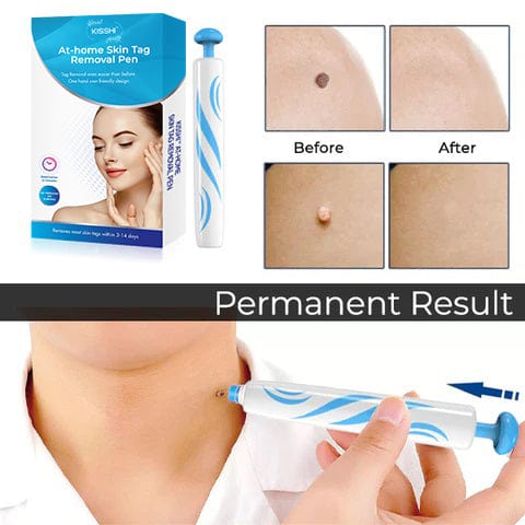 KISSHI™ At-home Skin Tag Removal Pen