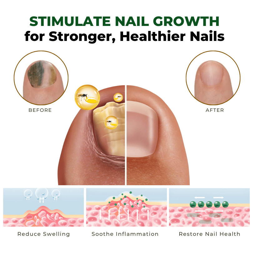 Kisshi™ NailNurture Bee Venom Fungus Treatment Oil