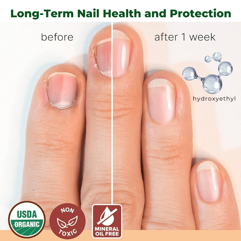 Kisshi™ NailNurture Bee Venom Fungus Treatment Oil