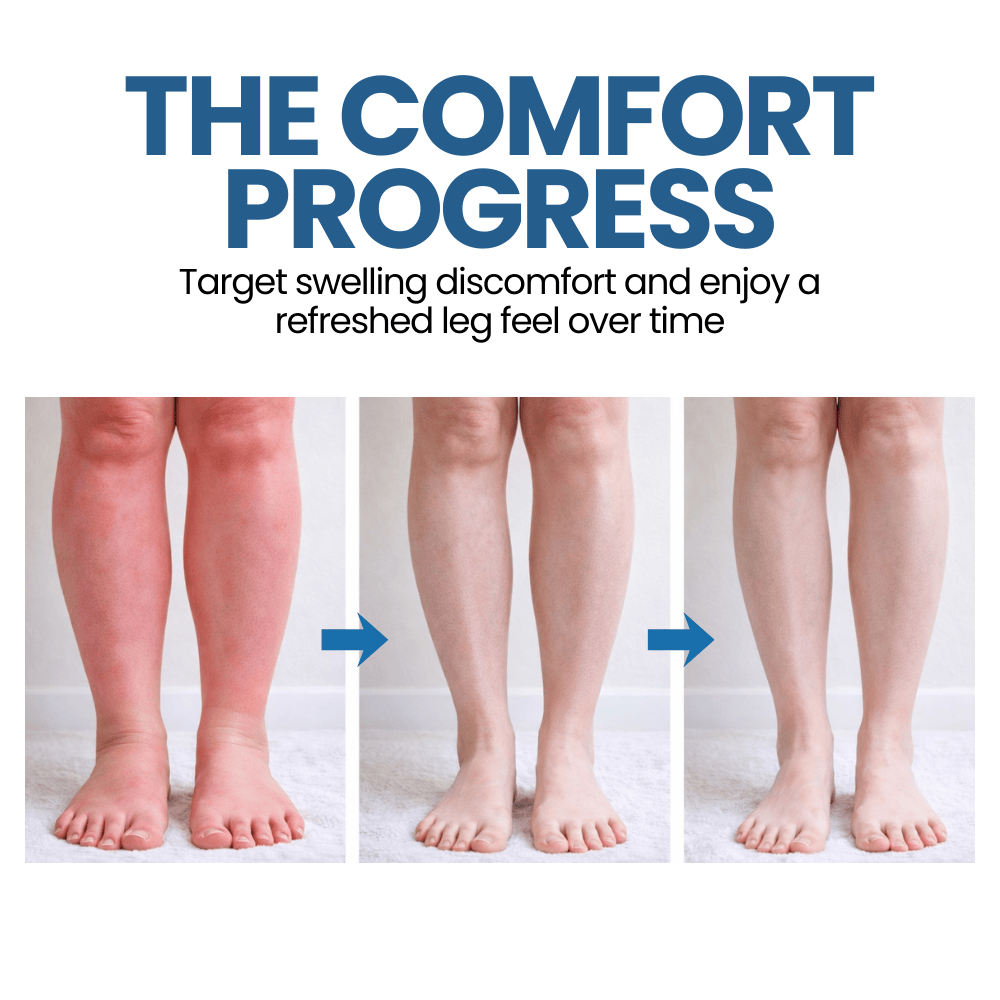 Lyyeto® Swelling Relief Roll-on Cooling Cream