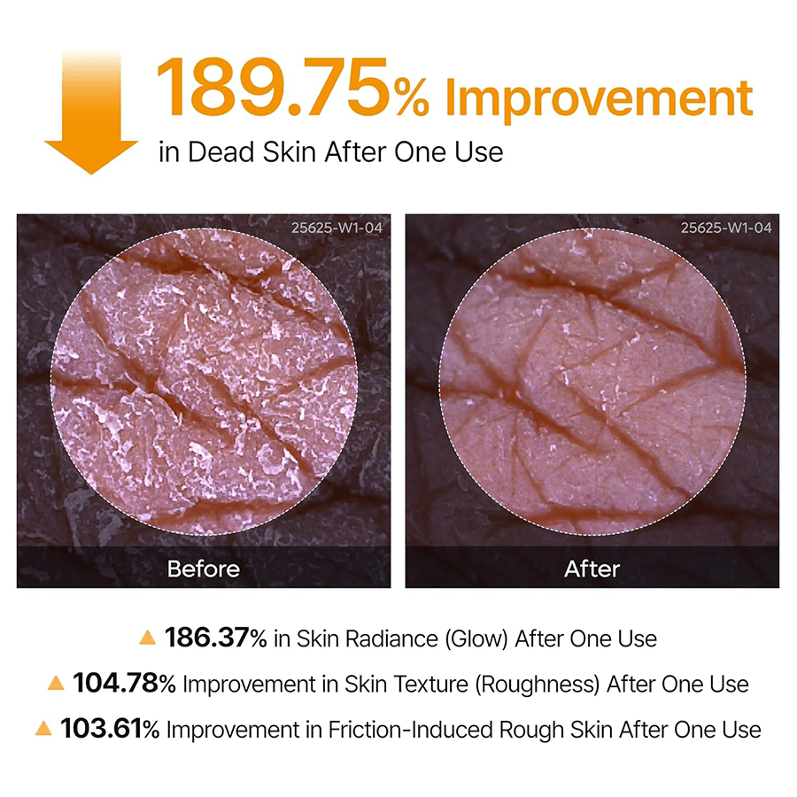 Dr. Meloxin Body Peel Shot Spray Face Peeling Kojic Acid Turmeric Spray 200ml