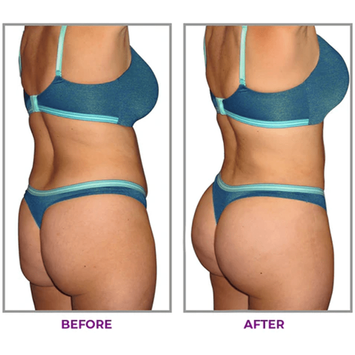 LUHAKA® Hip Plump Capric Oil D011