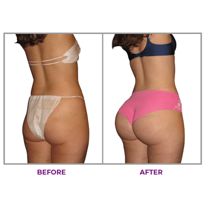 LUHAKA® Hip Plump Capric Oil D011