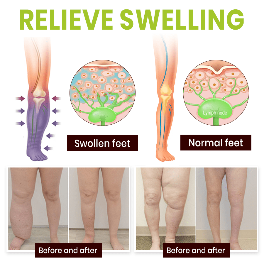 Lyyeto® Professional Leg Circulation Cream