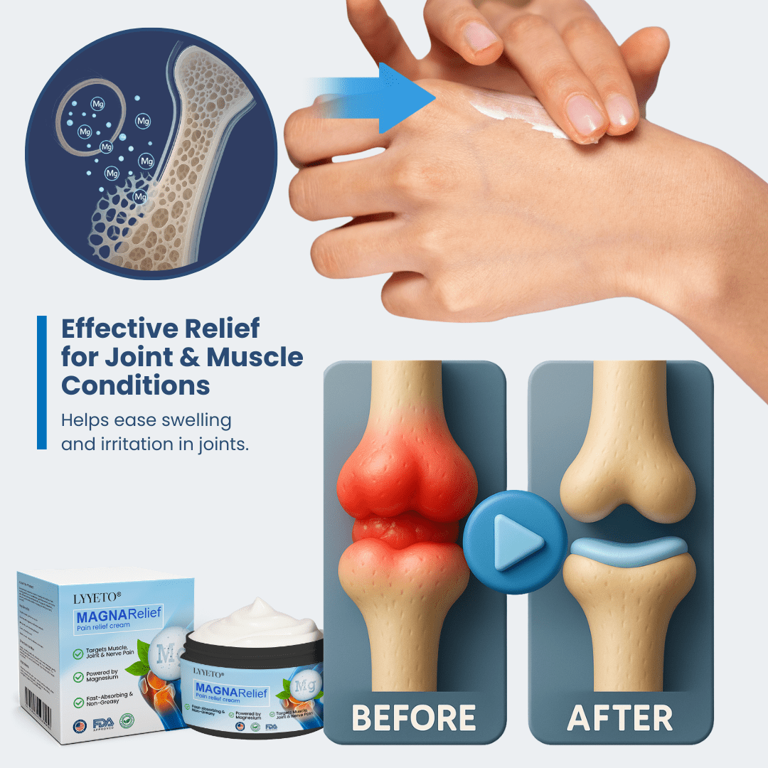 Lyyeto® Magna Relief Pain Relief Cream ACE 2