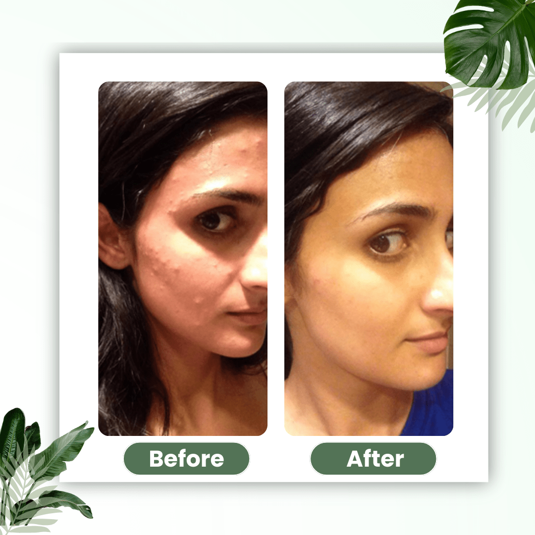LUHAKA® Green Tea Deep Cleanse Mask Stick ACE 1