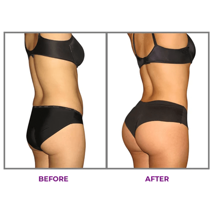 LUHAKA® Hip Plump Capric Oil D011