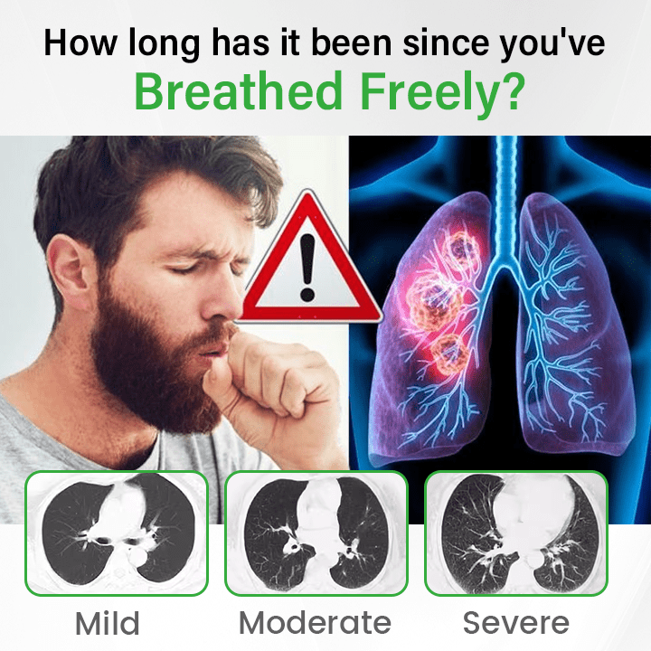 Lyyeto® Pulmovia Quercetin Lung Detox Inhaler ACE