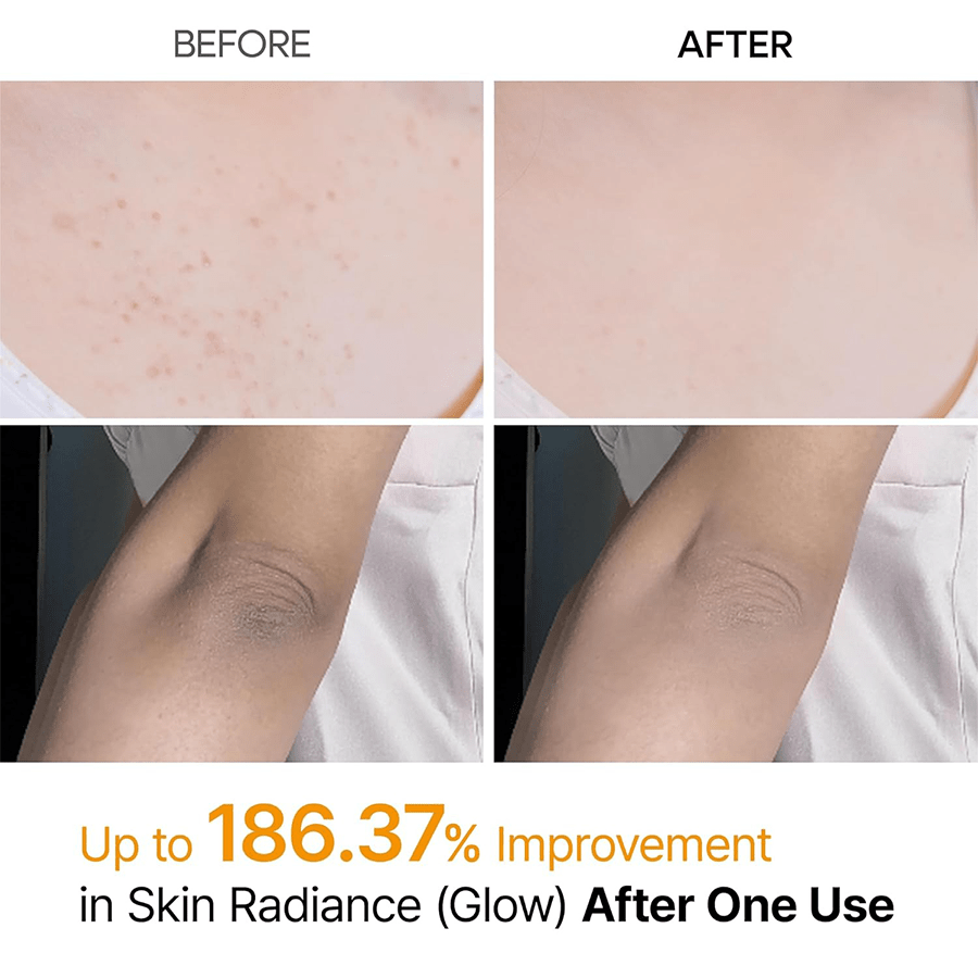 Dr. Meloxin Body Peel Shot Spray Face Peeling Kojic Acid Turmeric Spray 200ml