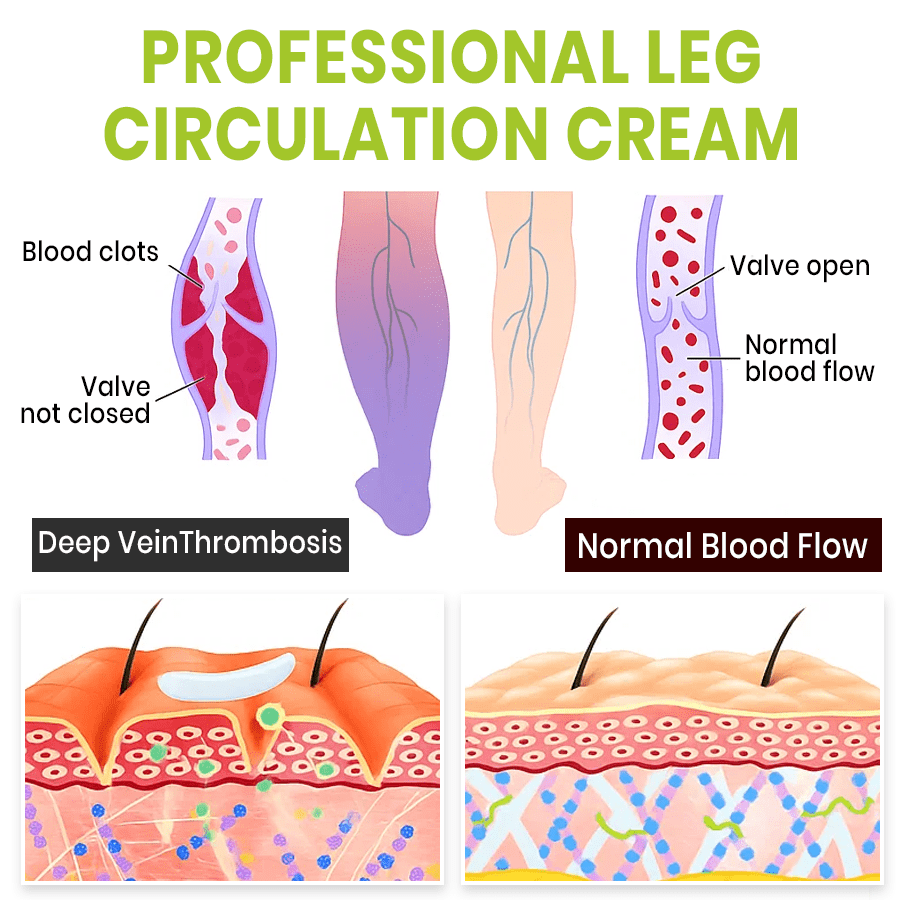 Lyyeto® Professional Leg Circulation Cream