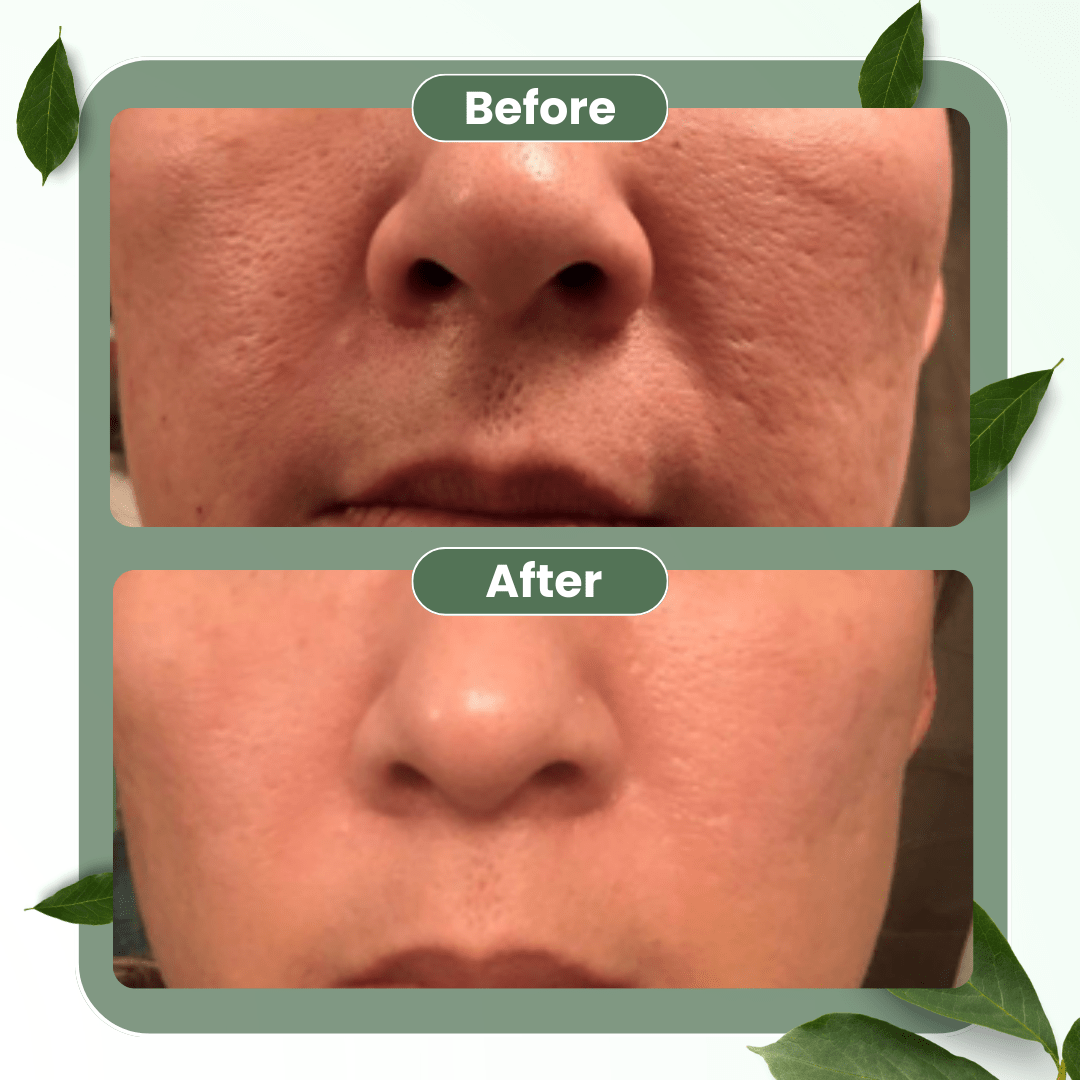 LUHAKA® Green Tea Deep Cleanse Mask Stick ACE 1
