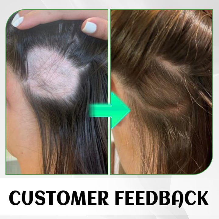 Biancat™ FolliHerb Hair Growth Spray 🔥Enjoy Special Discount🔥