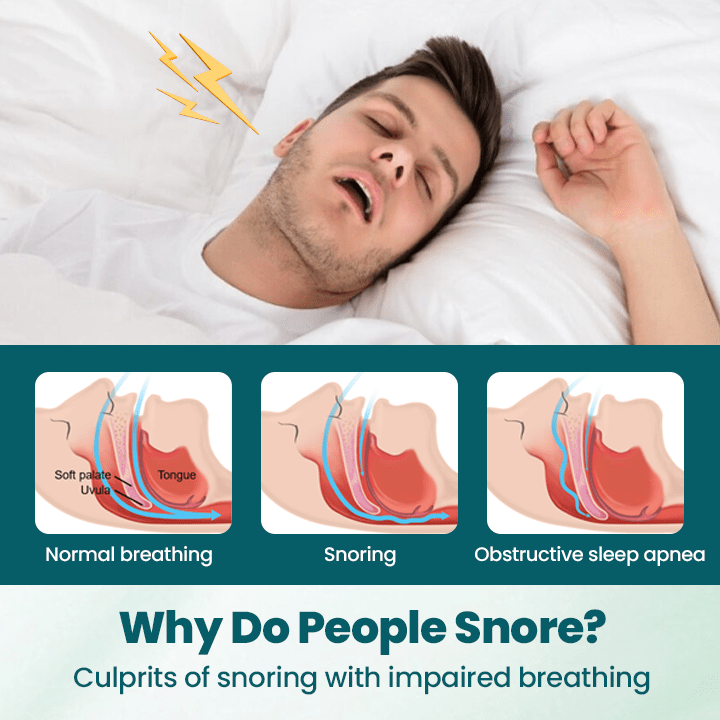 LUHAKA™ SilentBreathe Anti-Snore Patch