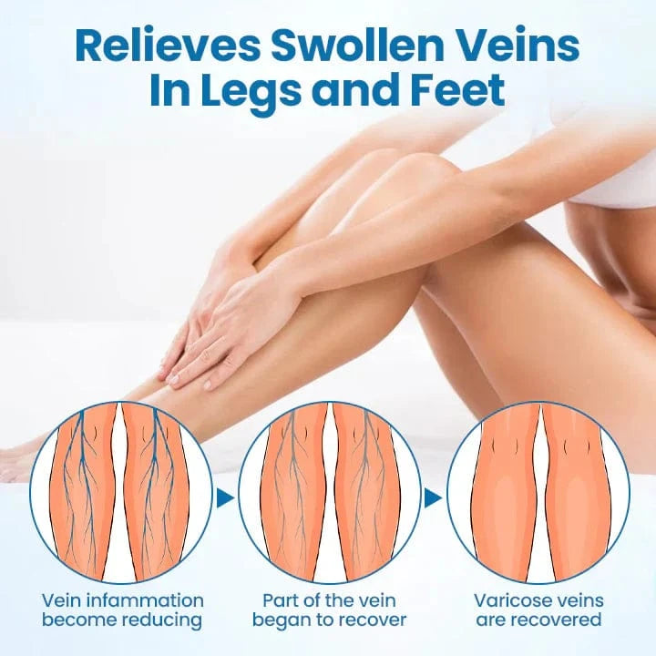 Lyyeto® VeinGuard Herbal Spray ACE -✅ Clinically proven to eliminate varicose veins in just 7 days!