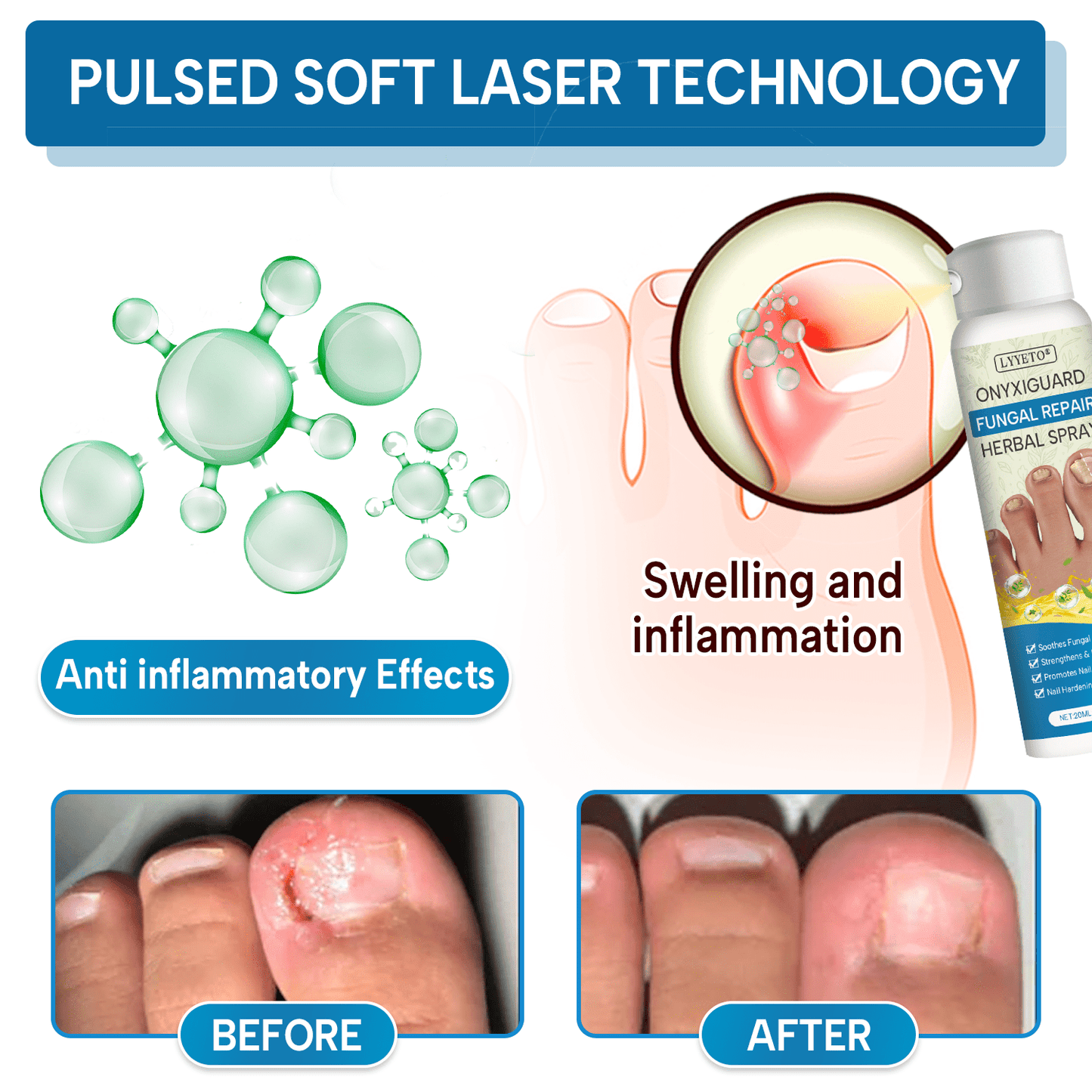 Lyyeto® OnyxiGuard Fungal Repair Herbal Spray_Ultra01