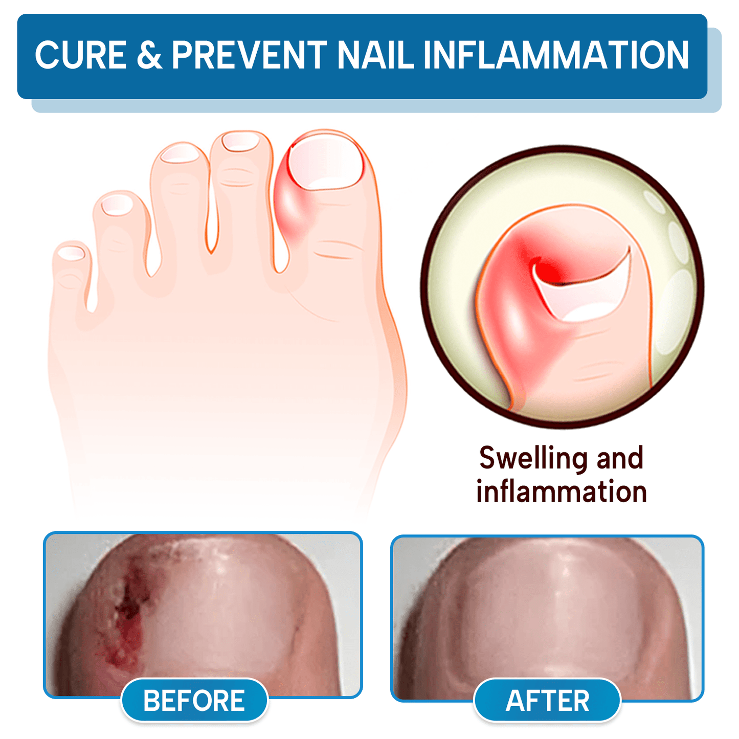 Lyyeto® OnyxiGuard Fungal Repair Herbal Spray_Ultra01
