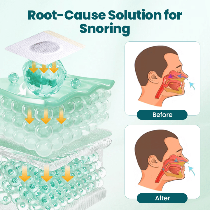 LUHAKA™ SilentBreathe Anti-Snore Patch