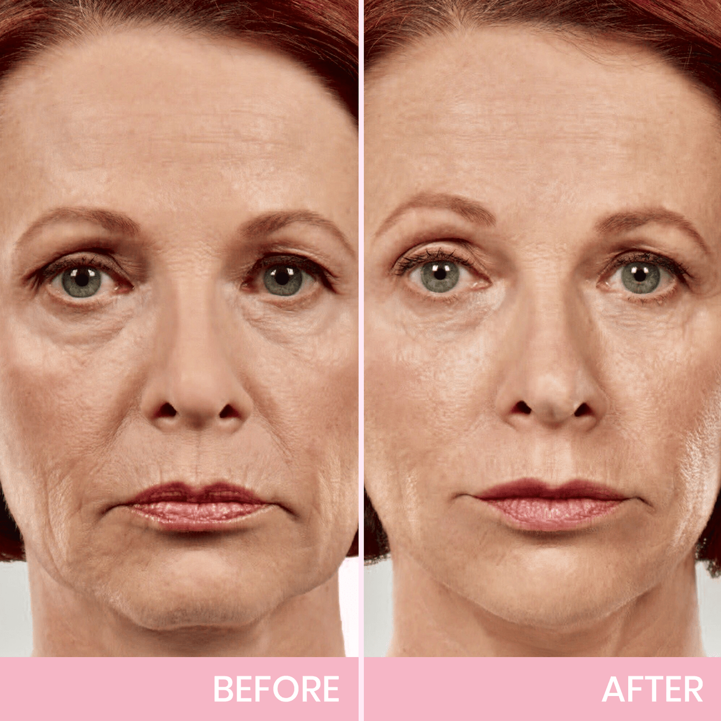 Luhaka™ V-Face Lifting Invisible Adhesive Tape 7