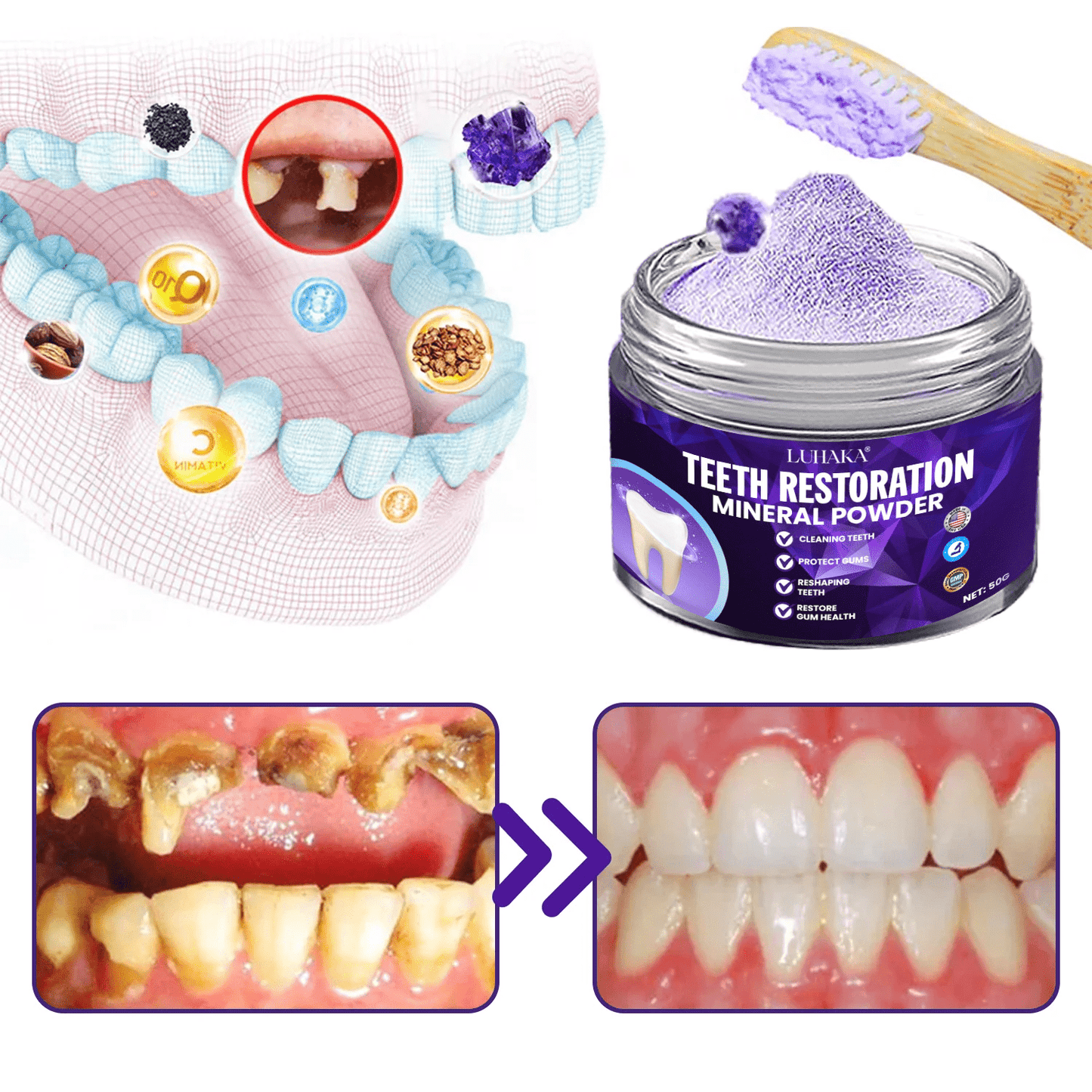 LUHAKA® Dental Repair Mineral Powder⭐6