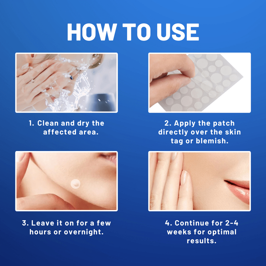 KISSHI™ Moles & Warts Removing Skin Tag Patch