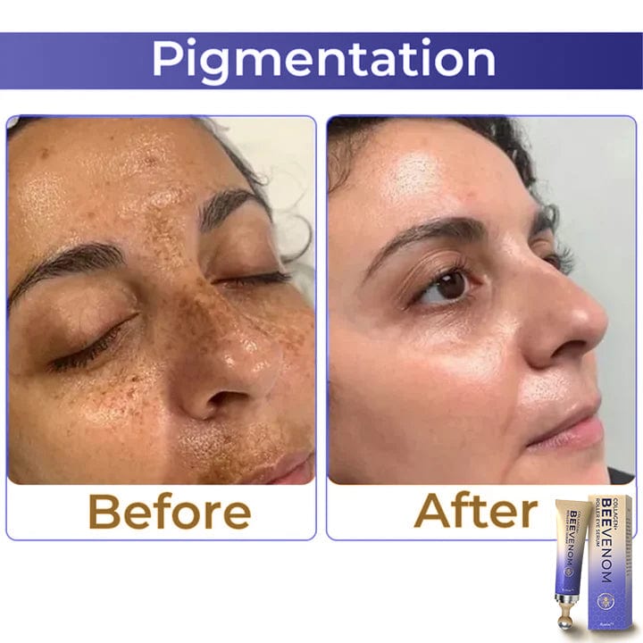 🐝 Kisshi™ Collagen+ Bee Venom Roller Eye Cream 🇺🇸 Dermatologist Approved