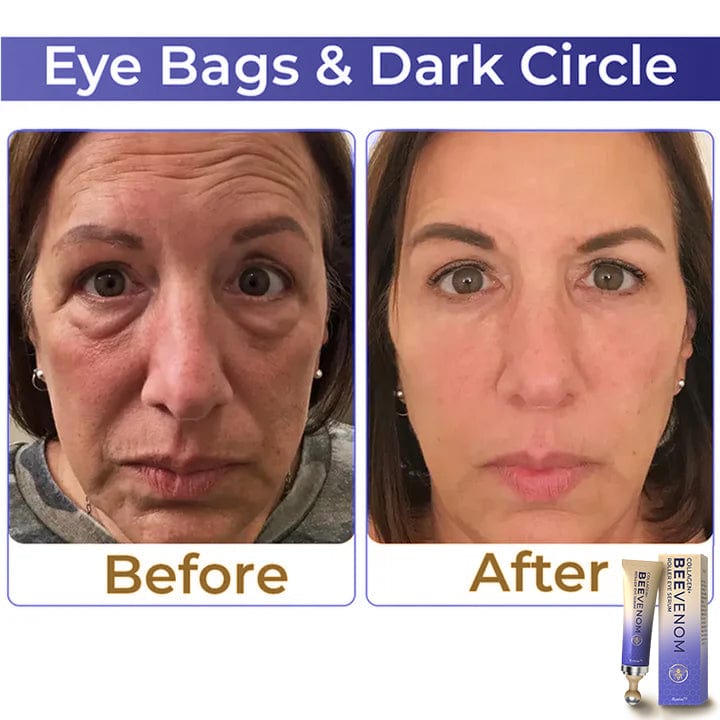 🐝 Kisshi™ Collagen+ Bee Venom Roller Eye Cream 🇺🇸 Dermatologist Approved