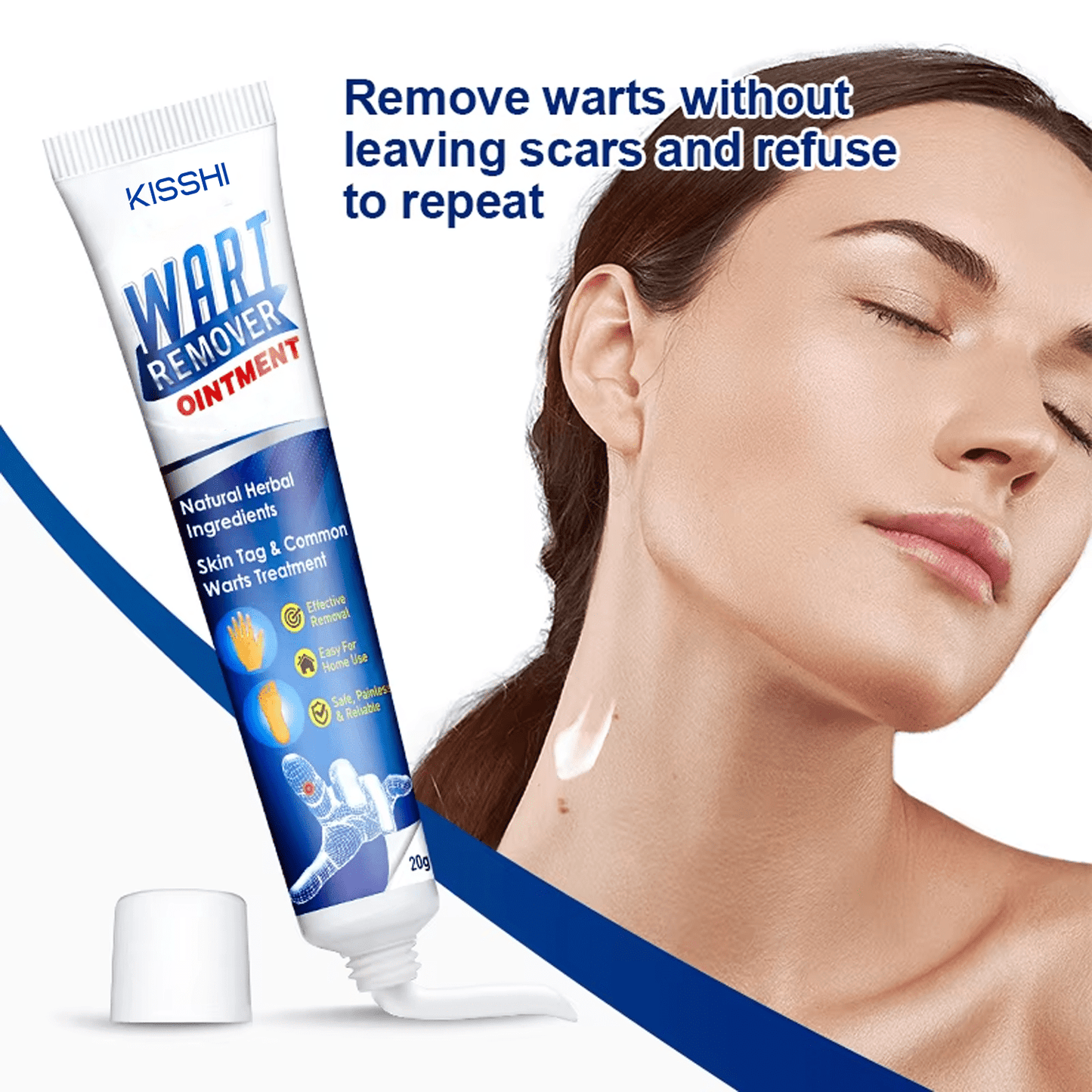 Kisshi™ WartsOff Instant Blemish Removal Cream