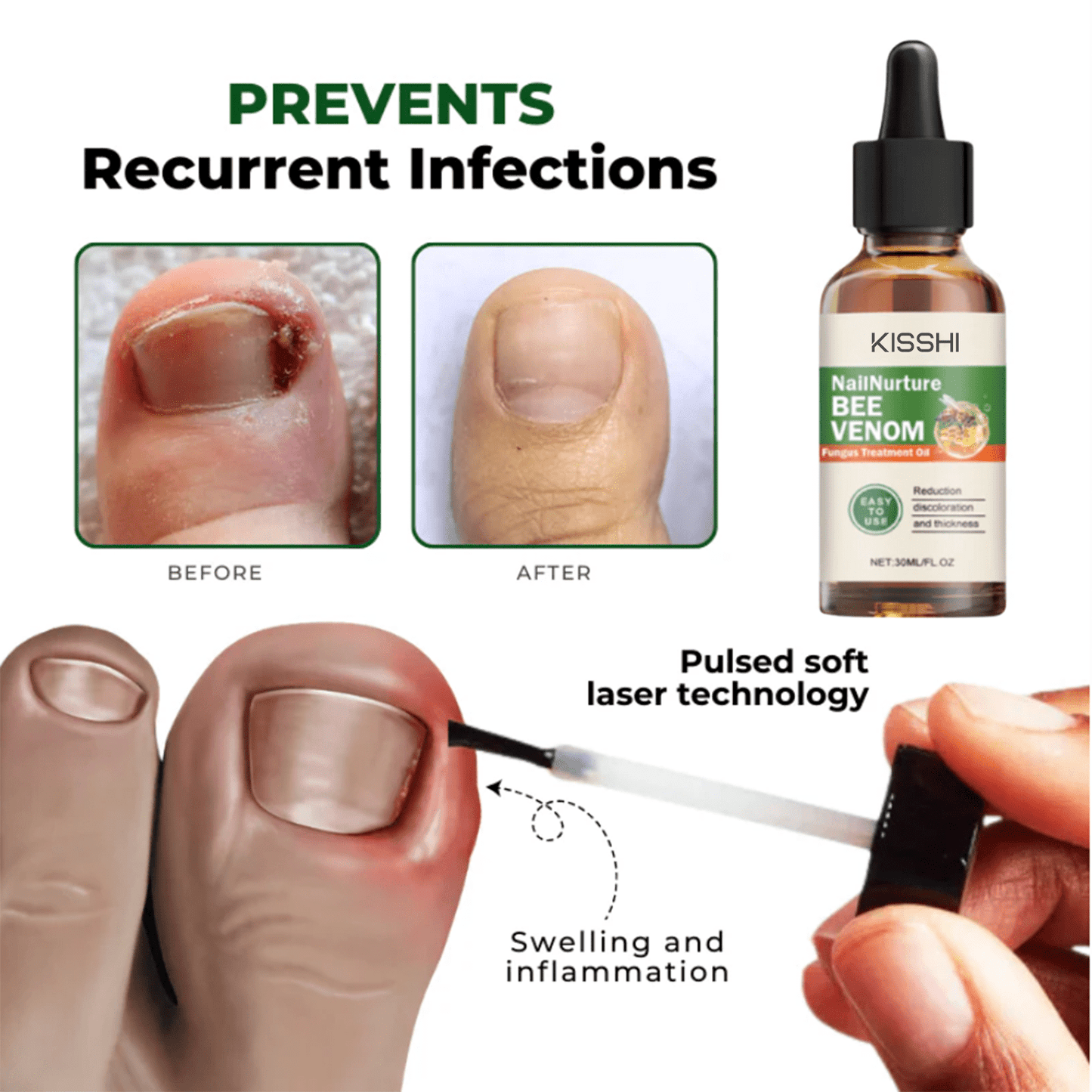 Kisshi™ NailNurture Bee Venom Fungus Treatment Oil