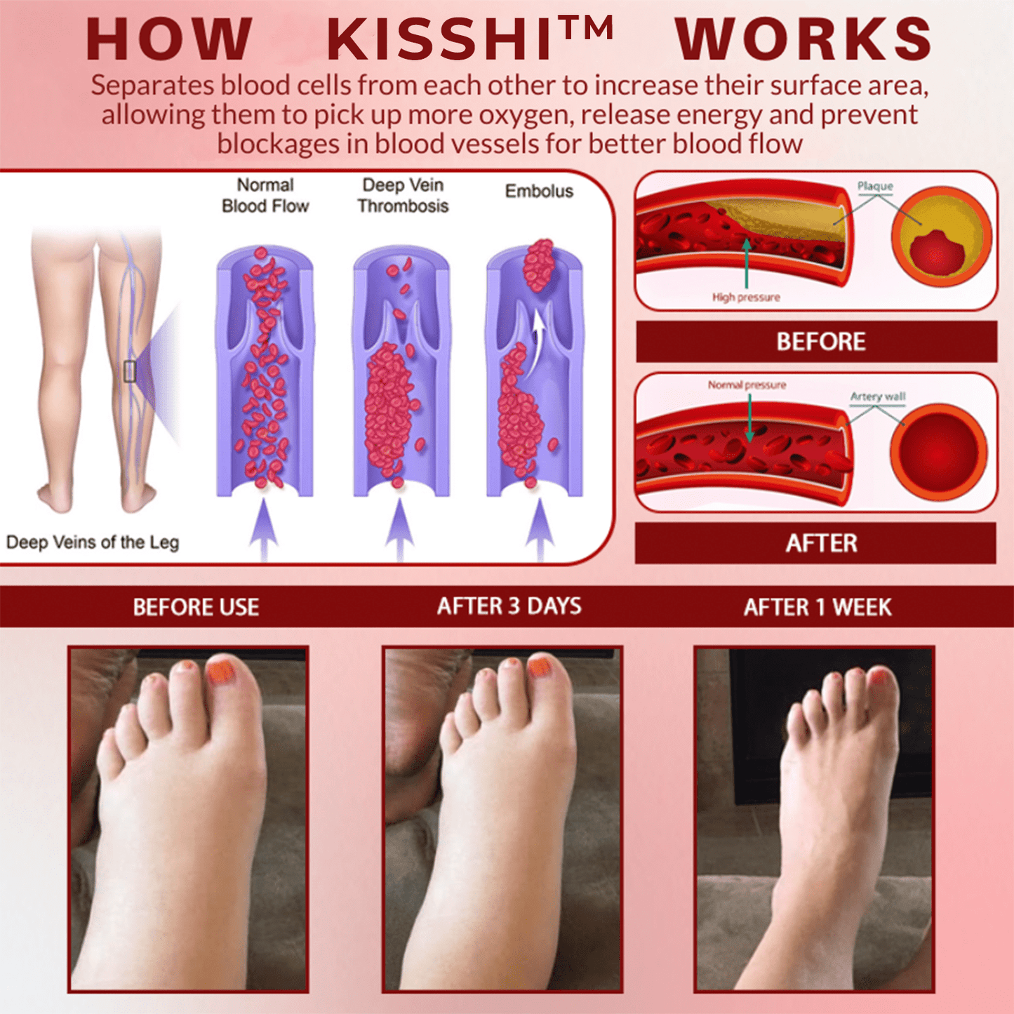 Kisshi™ Horse Chestnut SwellAway Massage Gel