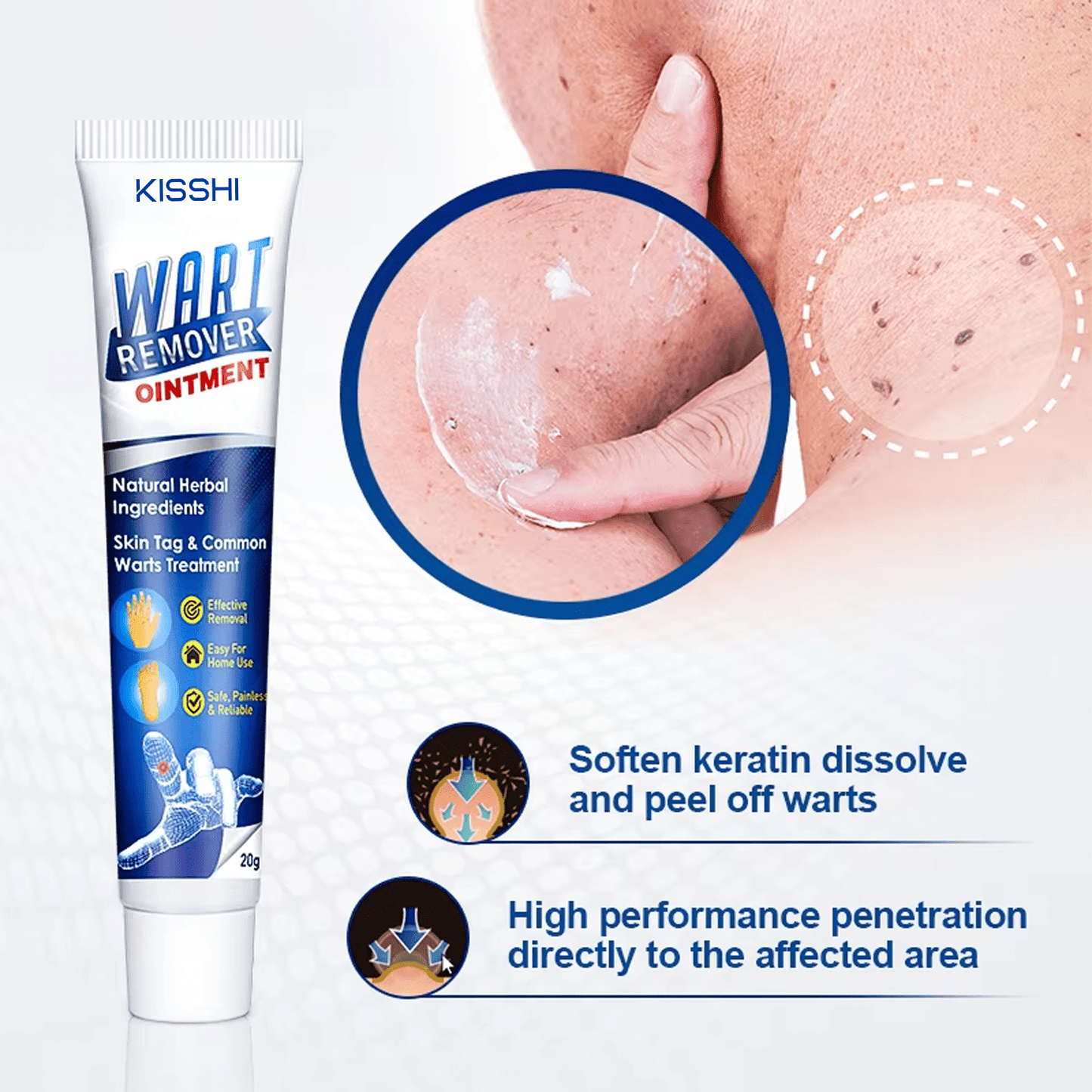 Kisshi™ WartsOff Instant Blemish Removal Cream