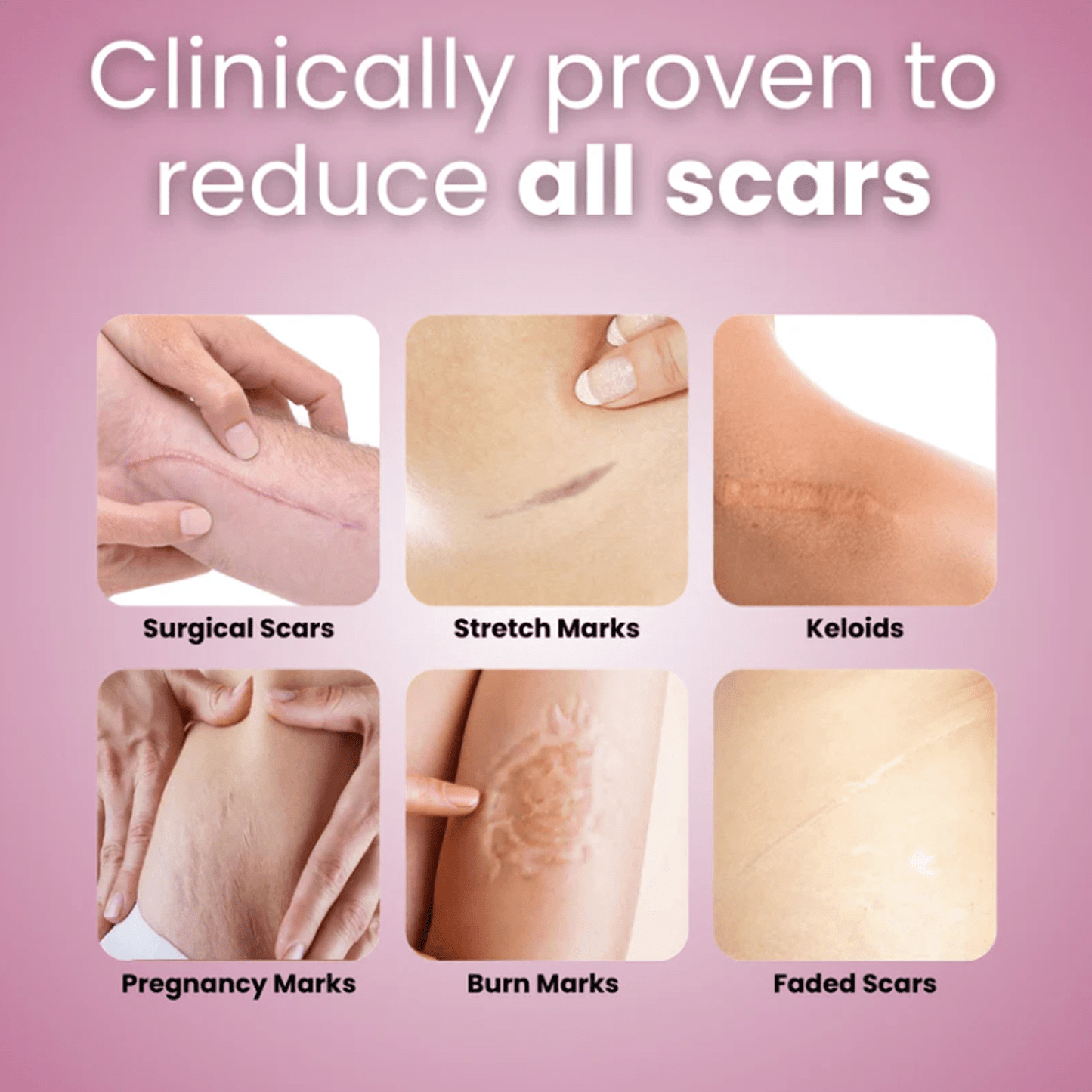 Luhaka™ Silicone Scar & Wrinkle Tape 2