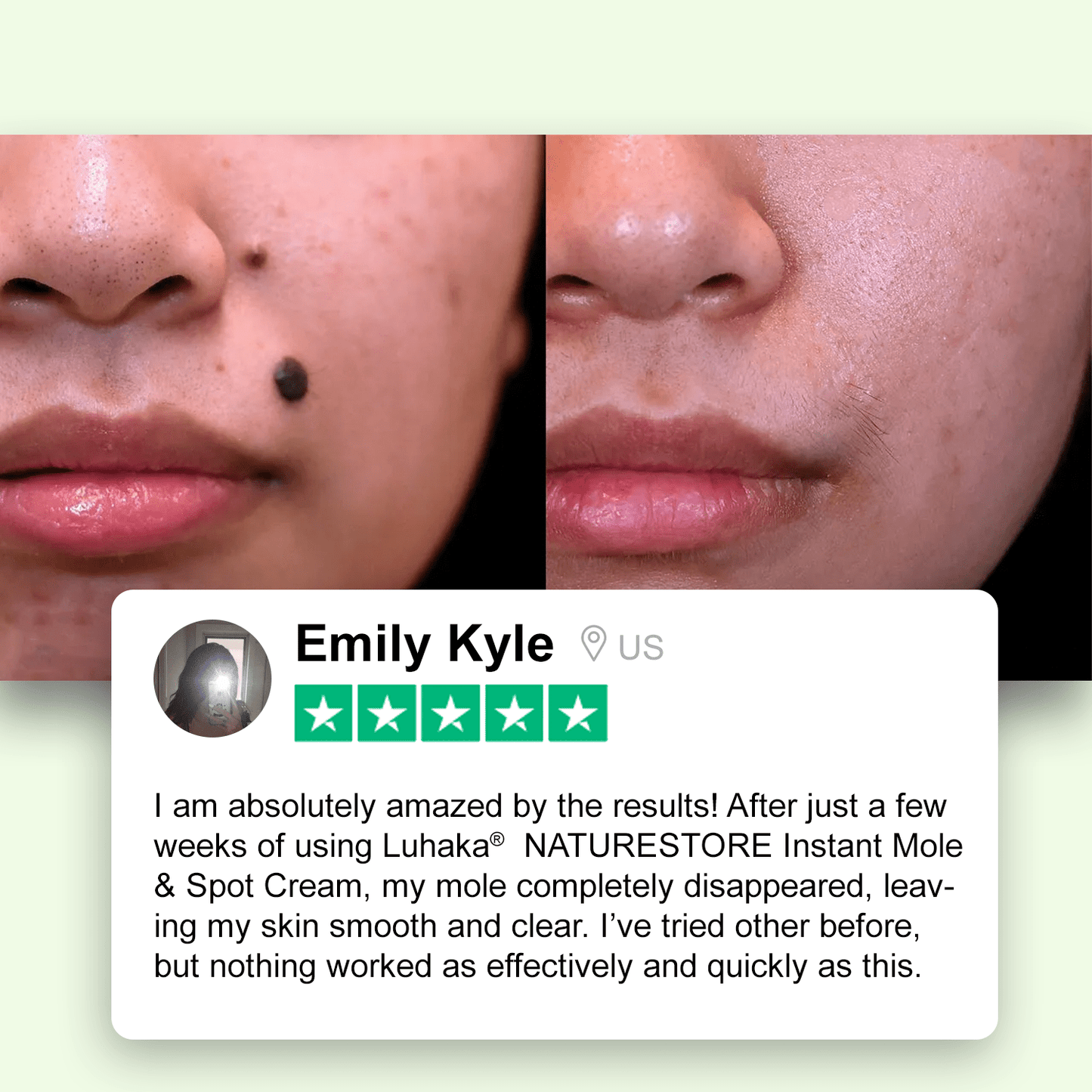 Luhaka® NATURESTORE Instant Mole & Spot Cream_Ultra01