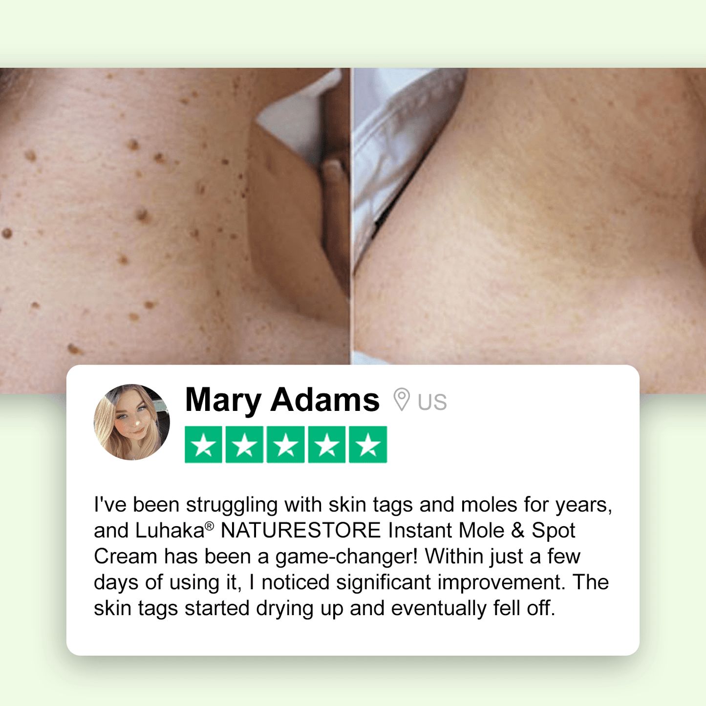 Luhaka® NATURESTORE Instant Mole & Spot Cream_Ultra01