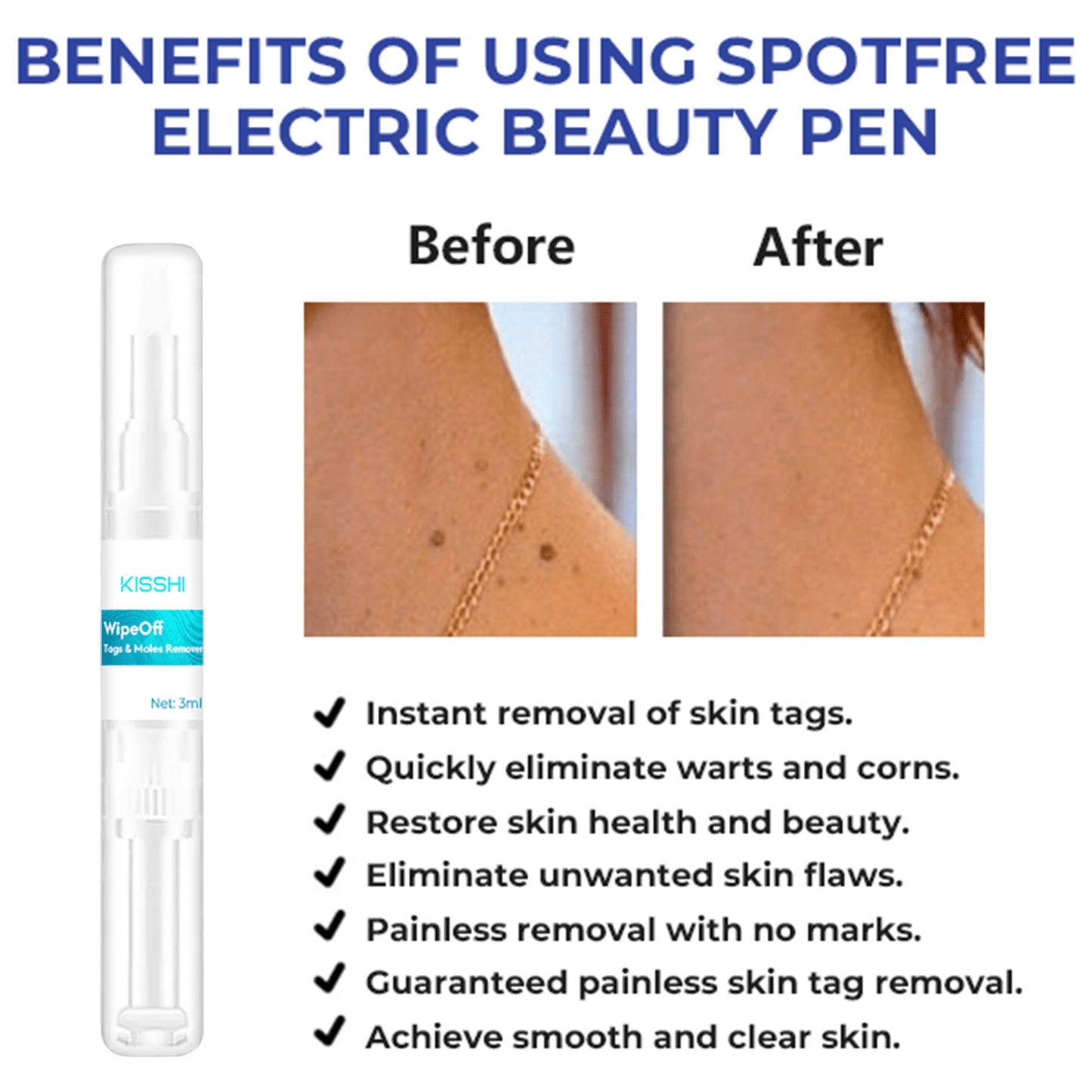 Kisshi™ WipeOff Tags & Moles Remover
