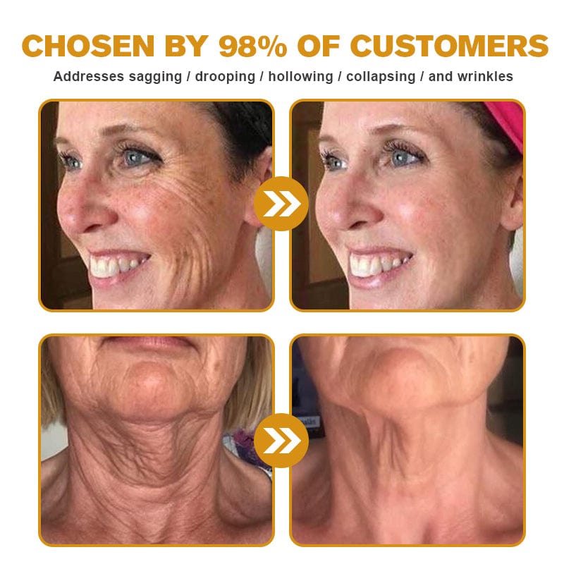 Kisshi™ Botox Bee Venom Wrinkle Removal Cream - New Year Sales