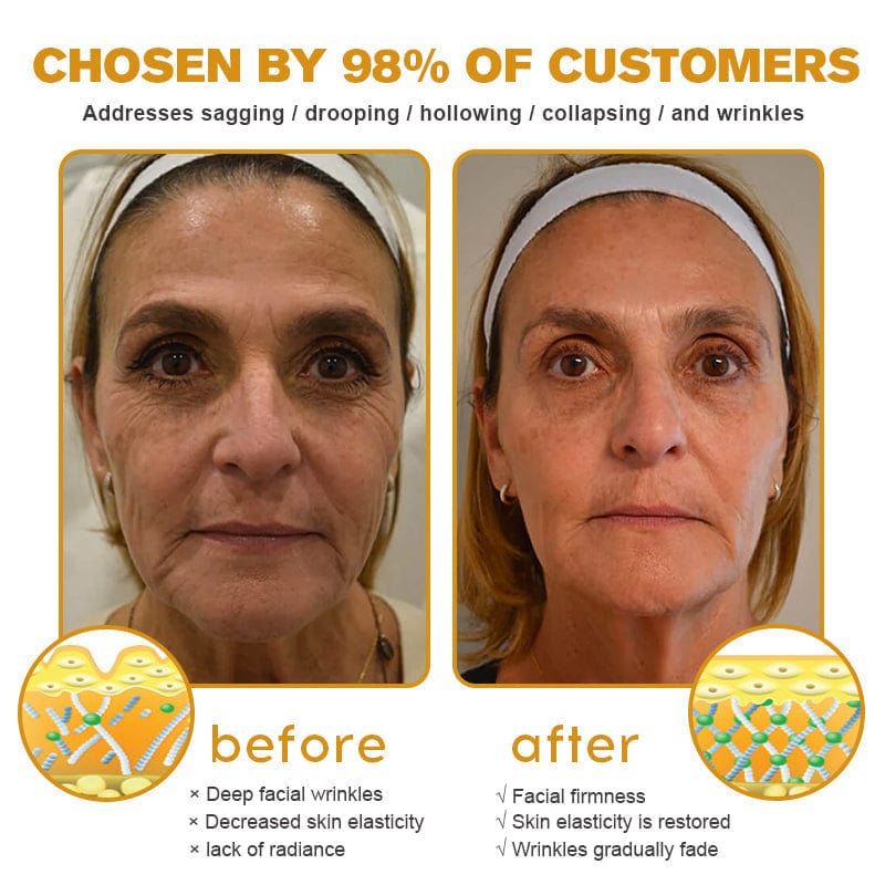 Kisshi™ Botox Bee Venom Wrinkle Removal Cream - New Year Sales
