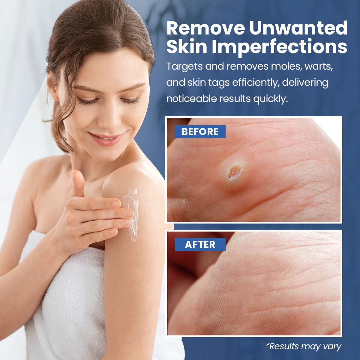 Luhaka® ClearWarts Instant Blemish Removal Cream