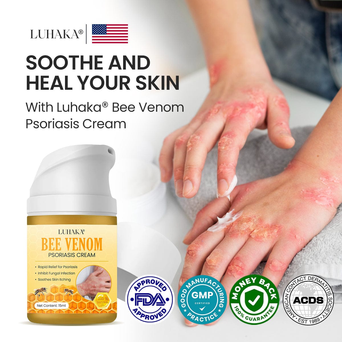 Luhaka® Bee Venom Psoriasis Cream