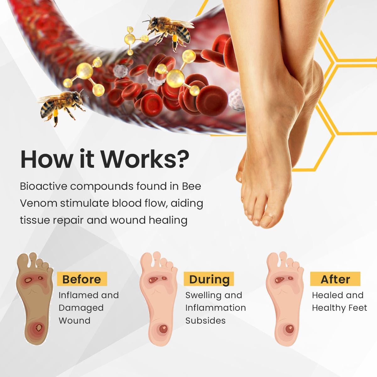 Luhaka™ Bee Venom Diabetic Foot Treatment Spray