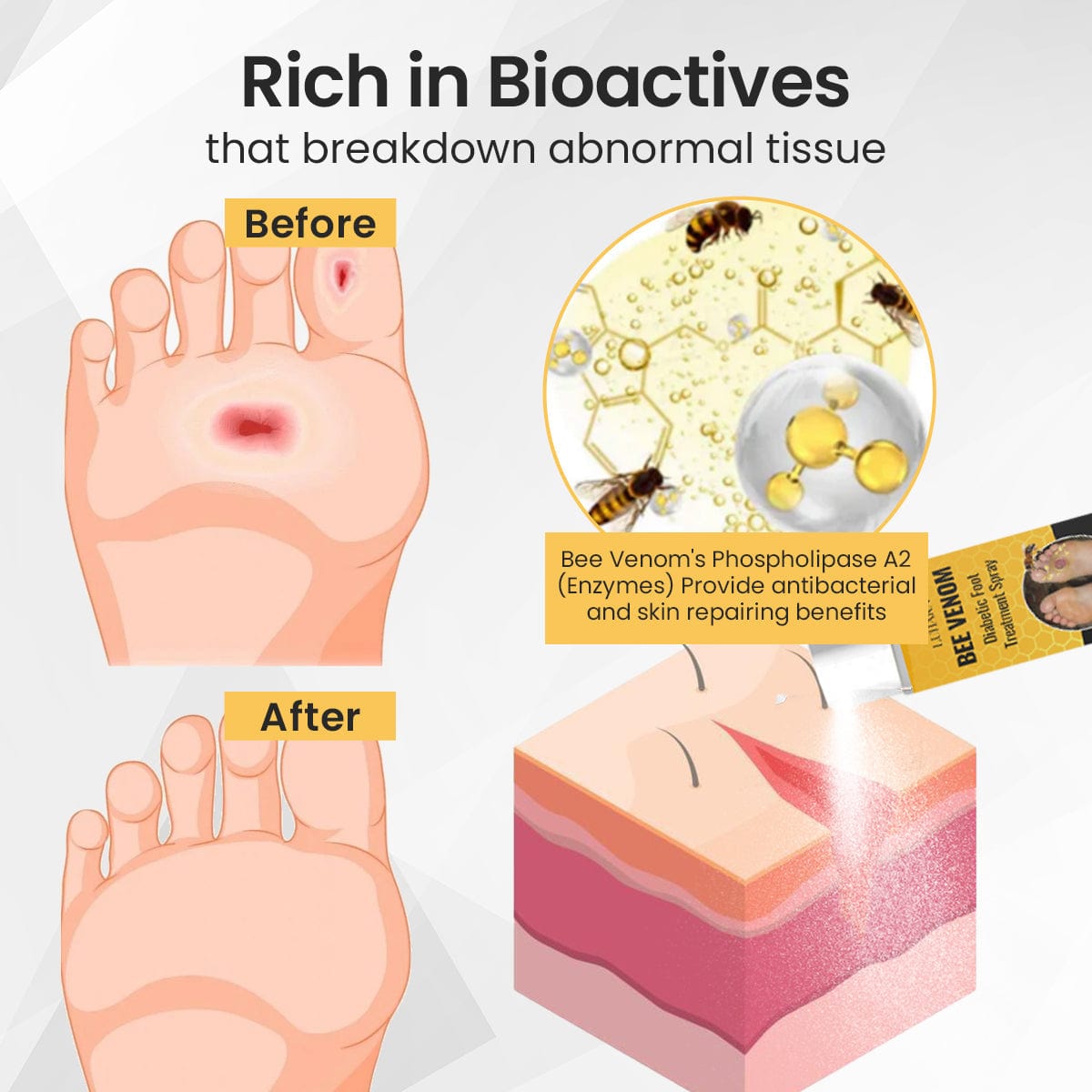 Luhaka™ Bee Venom Diabetic Foot Treatment Spray