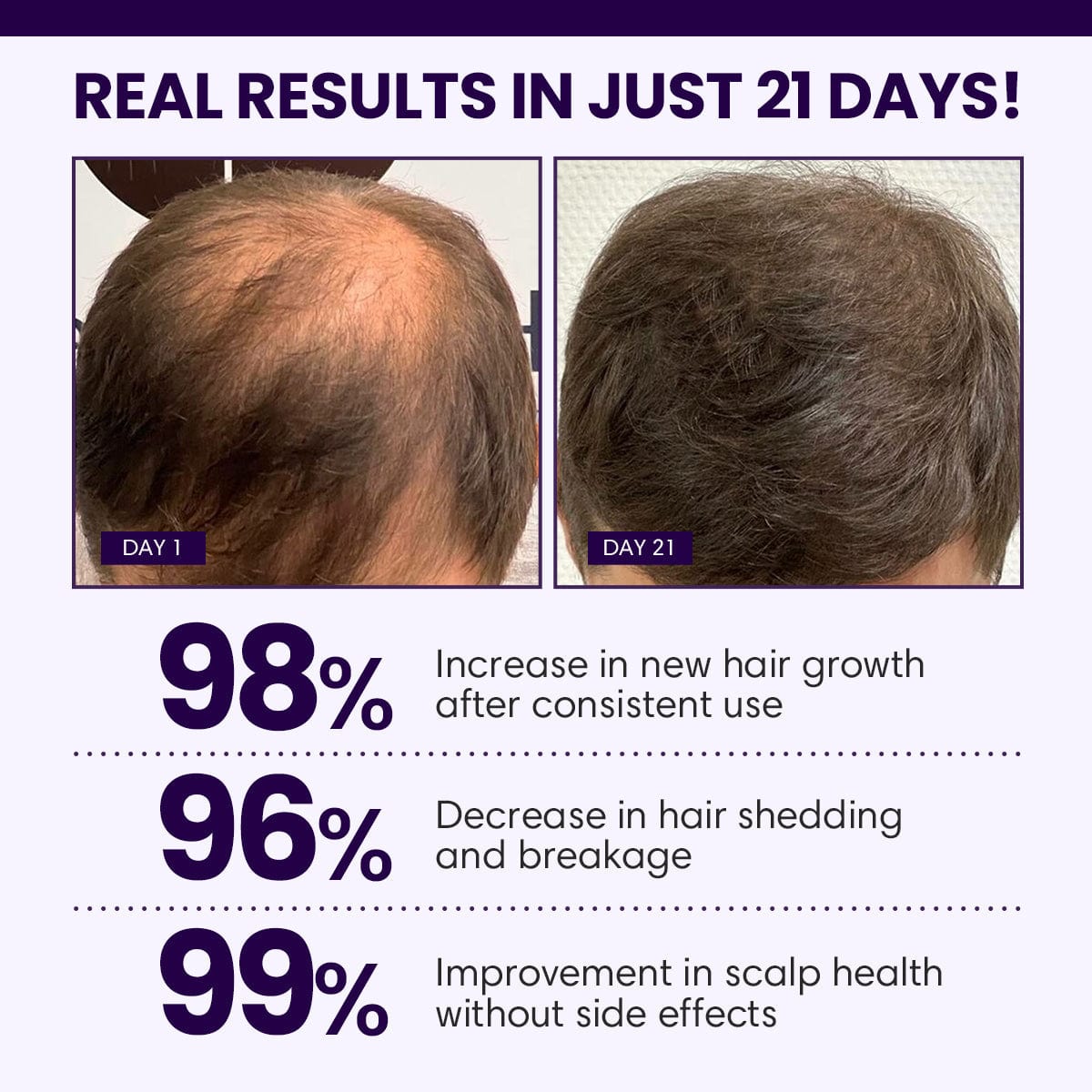 Luhaka™ FollicaMax 25,000 MCG Hair Growth Support ⚡️ 2