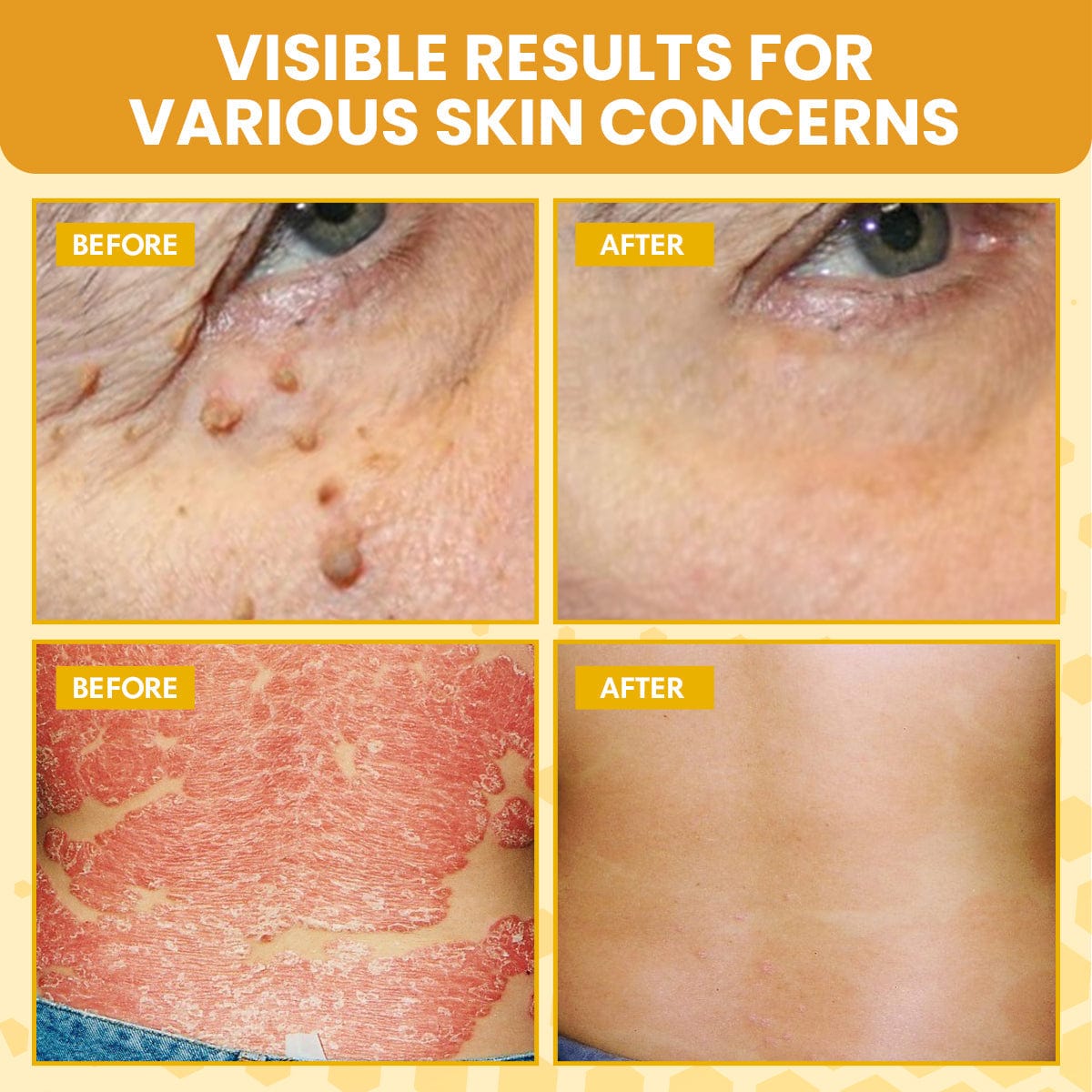 Luhaka™ Bee Venom Therapy Cream 40ml