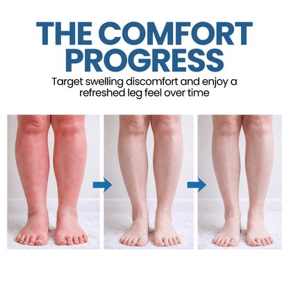 Lyyeto® Swelling Relief Roll-on Cooling Cream