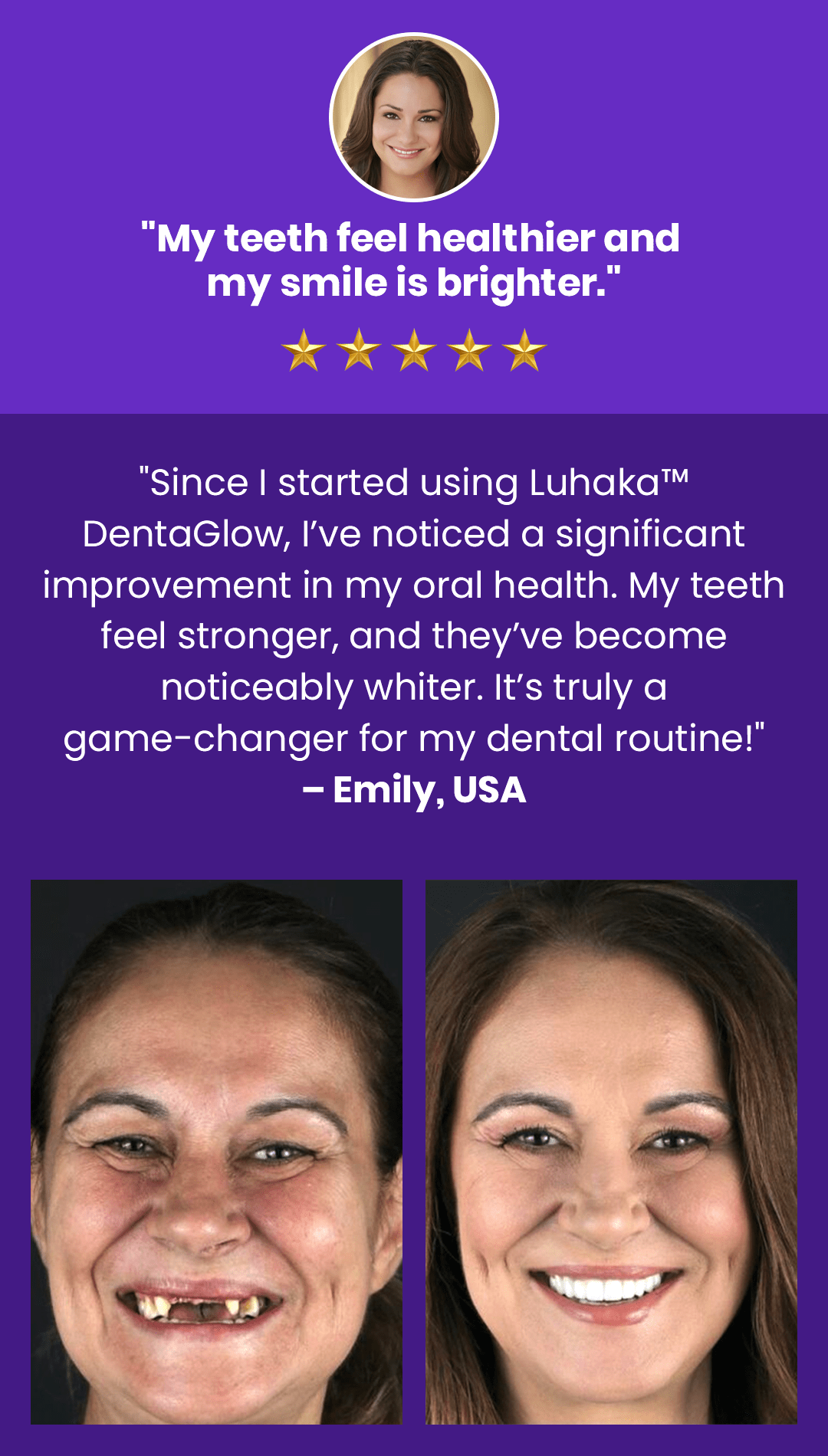 Luhaka™ DentaGlow Tooth & Gum Regeneration Booster 31 1 39b17ad9 d54e 48f9 ba4a 6be108407359