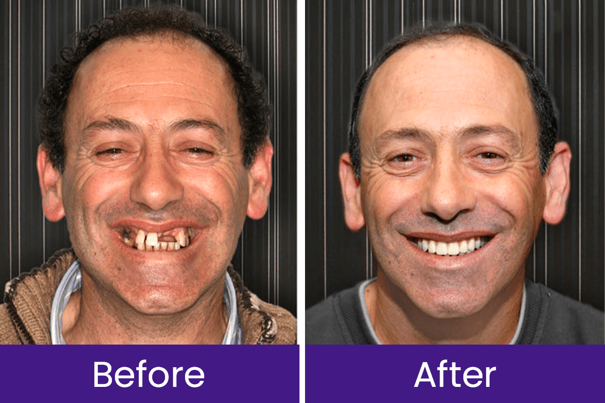 Luhaka™ DentaGlow Tooth & Gum Regeneration Booster 18 1 898e7595 9626 4178 9e25 533259b12395