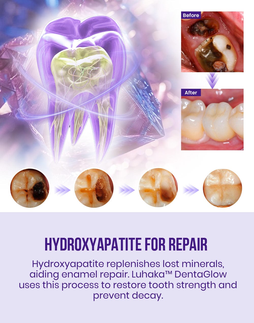 Luhaka™ DentaGlow Tooth & Gum Regeneration Booster 25 2 5fc6371a ee58 4266 b27b e160ba26e0a0