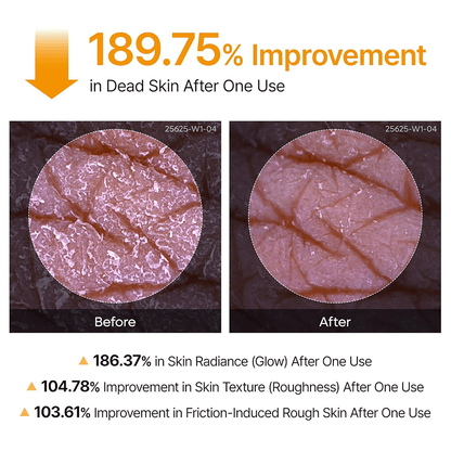 Dr. Meloxin Body Peel Shot Spray Face Peeling Kojic Acid Turmeric Spray 200ml