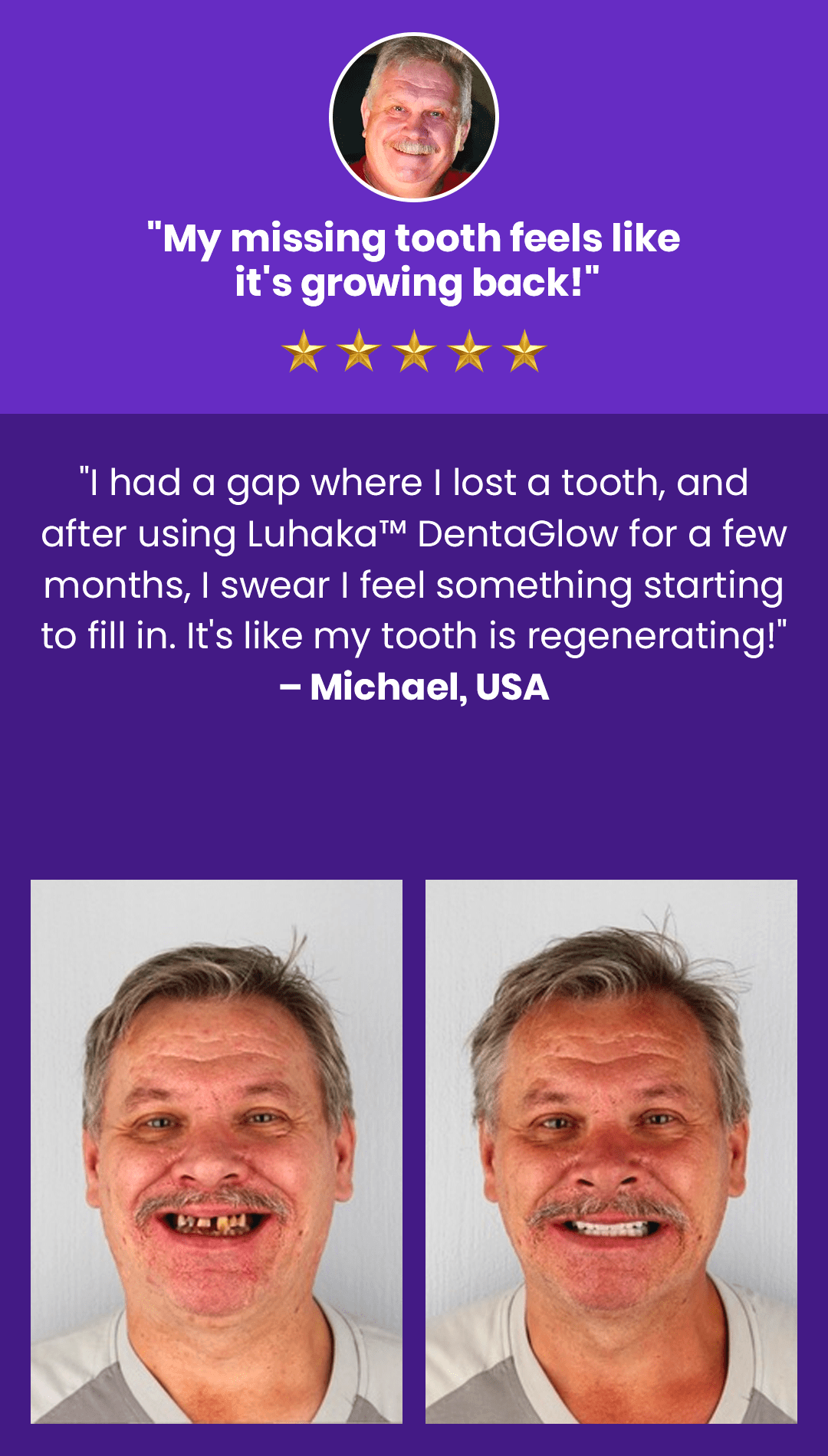 Luhaka™ DentaGlow Tooth & Gum Regeneration Booster 32 2 796aa29d 43f0 4507 b7f0 c7bba1ac3b8a