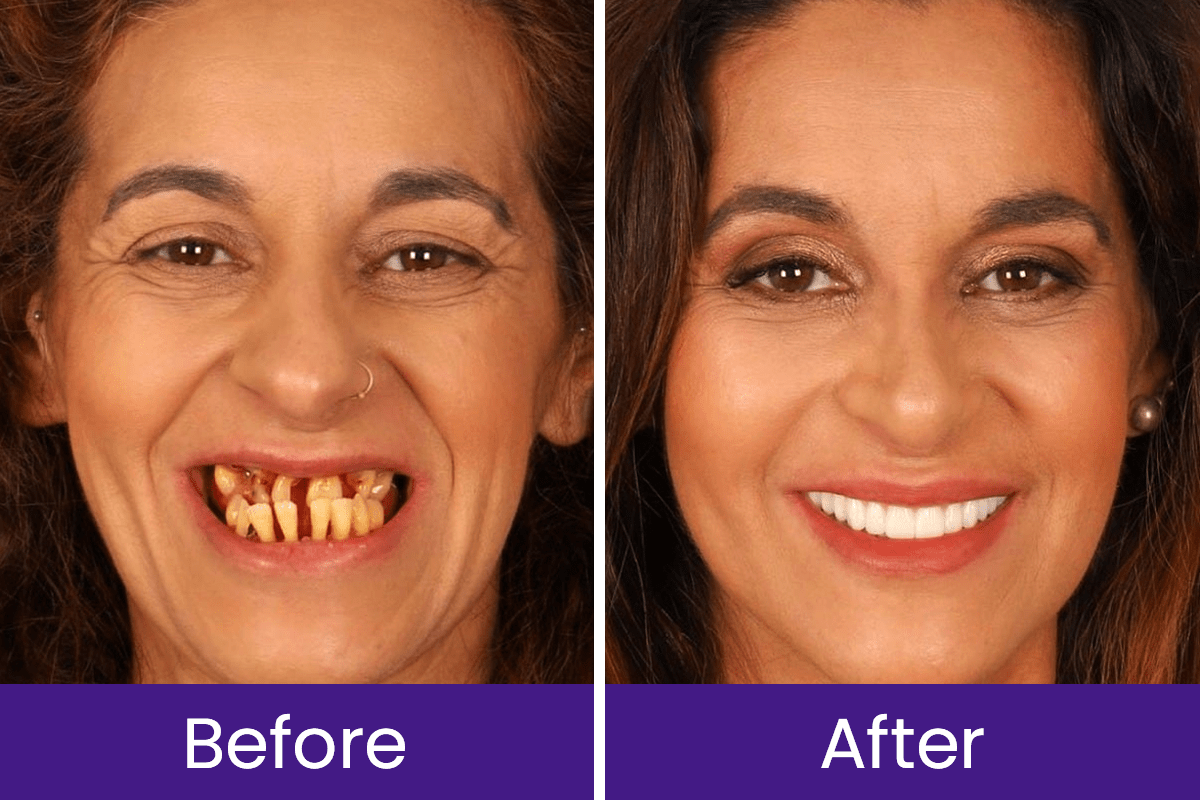 Luhaka™ DentaGlow Tooth & Gum Regeneration Booster 19 2 cbd63ef7 cdcf 4975 a75f 075a3260897d